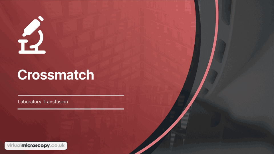 Crossmatch - animated explainer. How compatibility is tested between a patient and donor units: IAT crossmatch by tube and column, immediate spin and electronic issue.