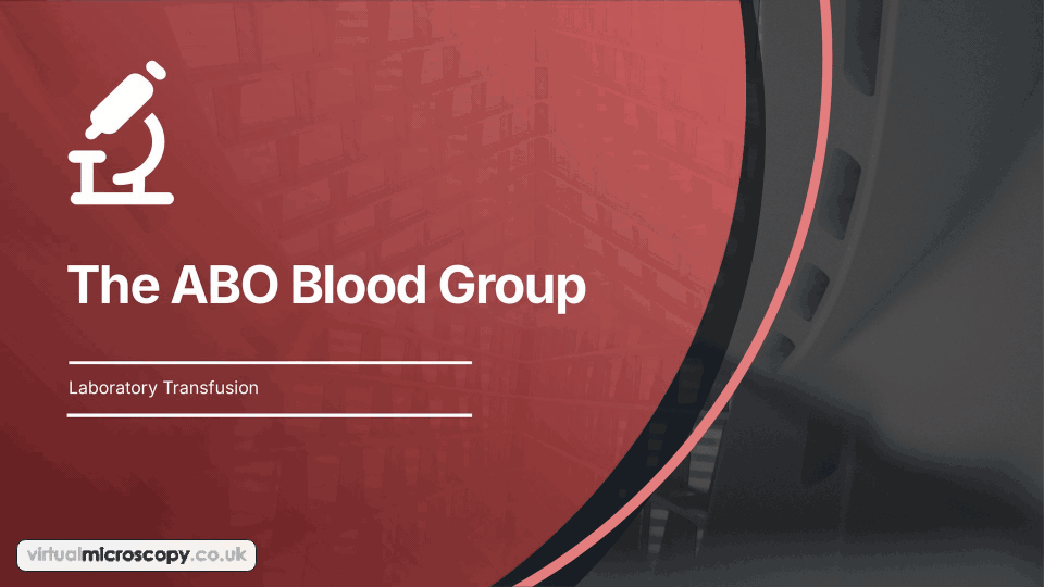 The ABO Blood Group - animated explainer. An introduction to the ABO system: how A and B antigens are made, A1 and A2, naturally occurring anti-A and anti-B, inheritance and grouping.